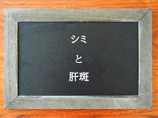 シミと肝斑の違いはとは？違いを解説